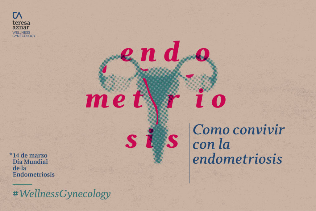 Beneficios del aceite de oliva virgen extra para la endometriosis