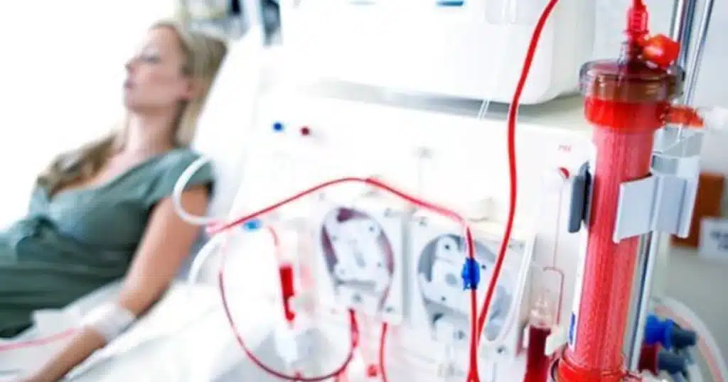 tomar El AOVE para pacientes en hemodiálisis