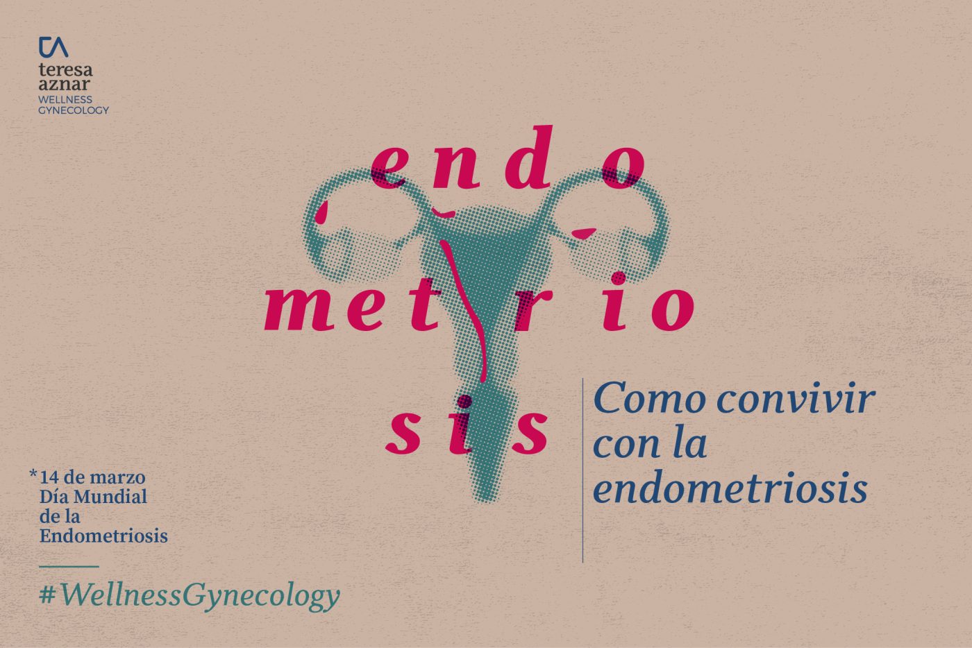 Beneficios del aceite de oliva virgen extra para la endometriosis