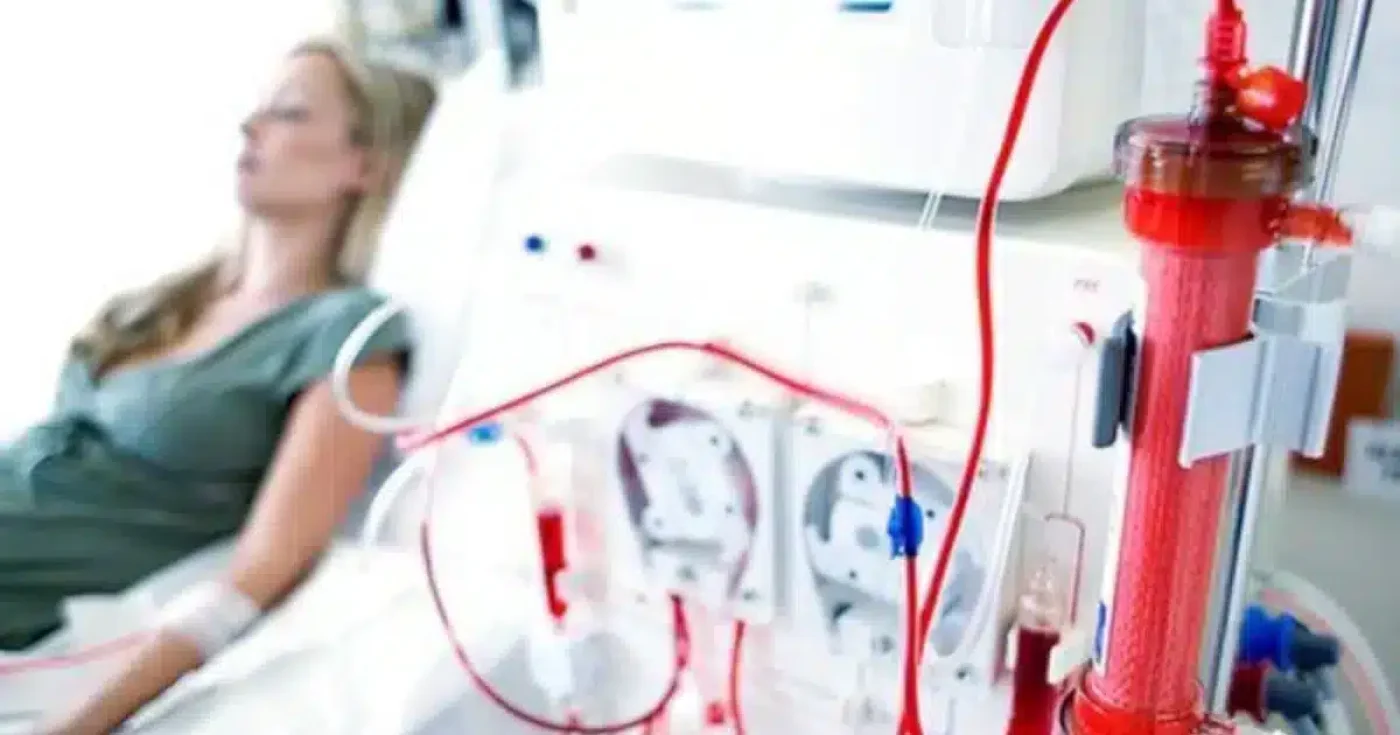 tomar El AOVE para pacientes en hemodiálisis